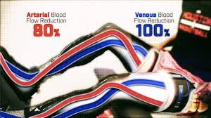 Blood flow rehabilitation Image